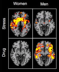 Study Suggests Gender Differences in Root Causes of Addiction